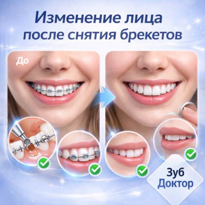 Изменение лица после брекетов