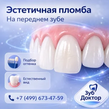 Эстетическая пломба на передний зуб: как выбрать оттенок