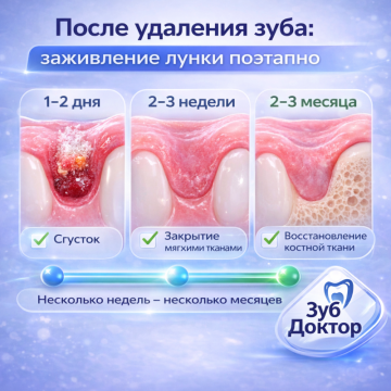 Заживление после удаления зуба