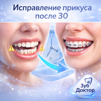 Ортодонтия после 40 лет: реально ли исправить прикус?