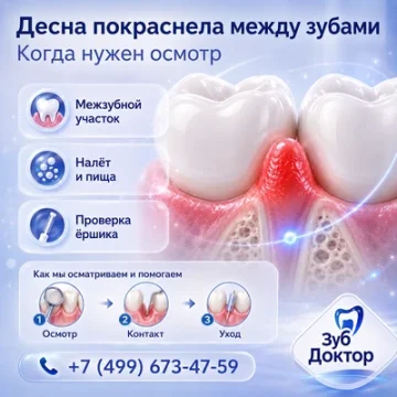 Десна покраснела между зубами: когда нужен осмотр