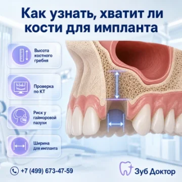 Как узнать, хватит ли кости для импланта