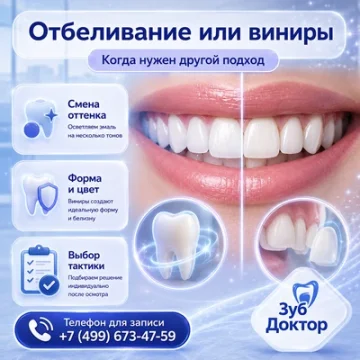 Отбеливание или виниры