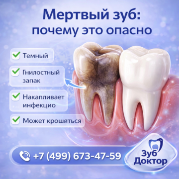 Может ли мертвый зуб не болеть
