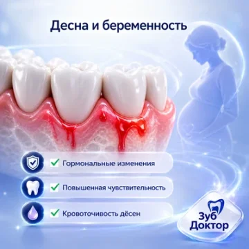 Десна кровит при беременности: что можно проверить безопасно
