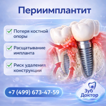 Что делать, если воспалились десны вокруг импланта?