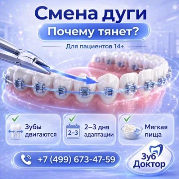 Зачем меняют дуги на брекетах