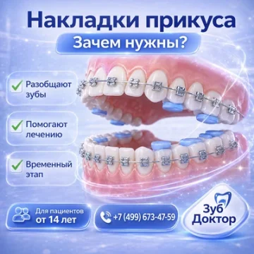 Турбонакусочные накладки: почему с ними неудобно жевать