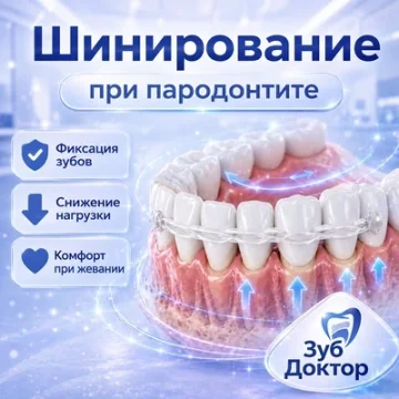 Шинирование зубов при пародонтите: зачем фиксируют подвижные зубы