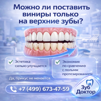 Виниры только на верхние зубы