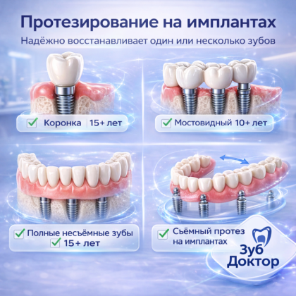 Протезирования после имплантации?