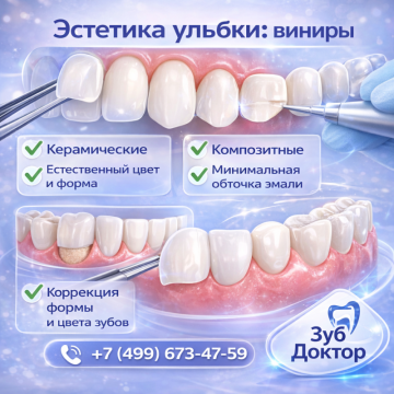 Что такое винир