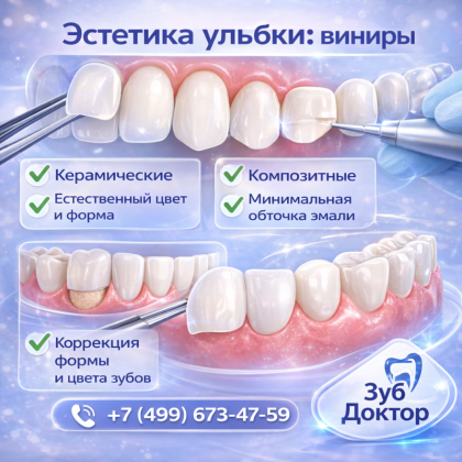 Что такое винир