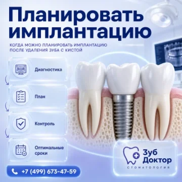 Планировать имплантацию