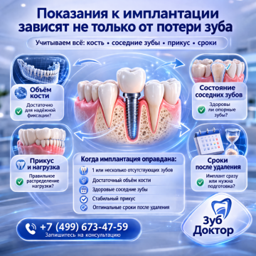 Показания к Установке Имплантов