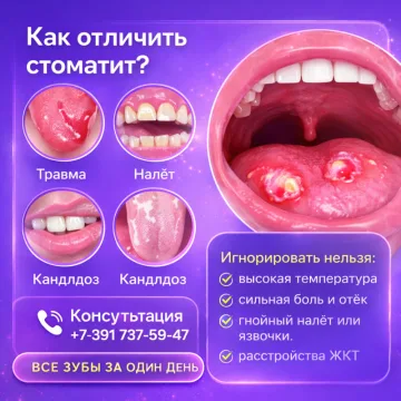 Стоматит