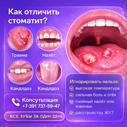 Стоматит