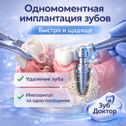 Одномоментная имплантация зубов