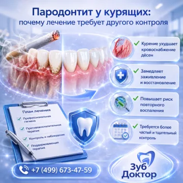 Пародонтит у курящих: почему лечение требует другого контроля