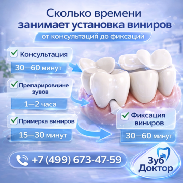 Время установки виниров