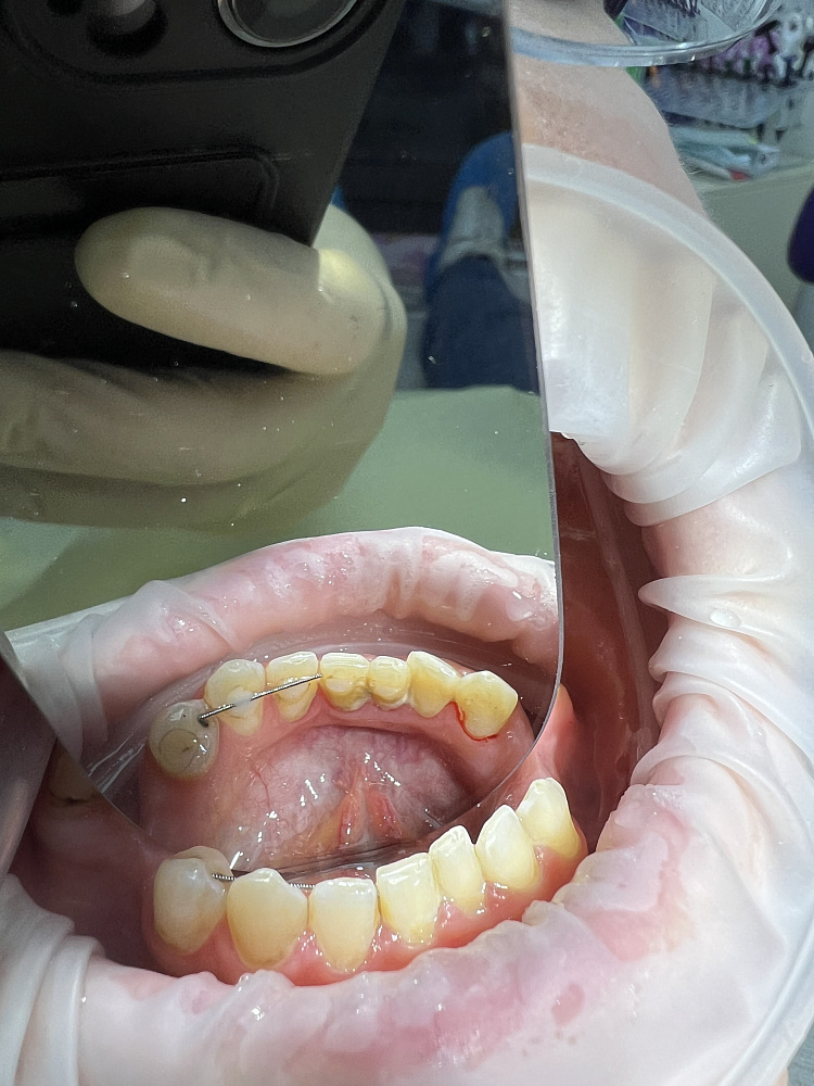 Состояние до лечения