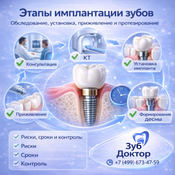 Этапы имплантации зубов
