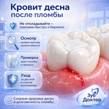 Десна кровит после пломбы: что проверить