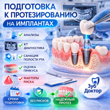 Протезирование на имплантах