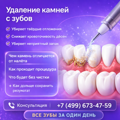 Удаление камней с зубов