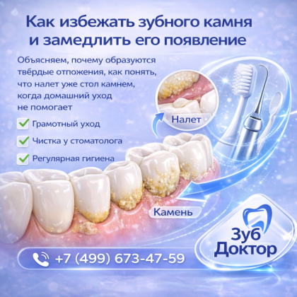 Как избежать зубного камня?