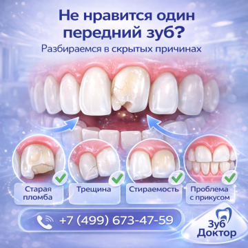 Не нравится только передний зуб