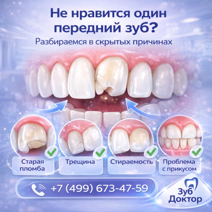 Не нравится только передний зуб