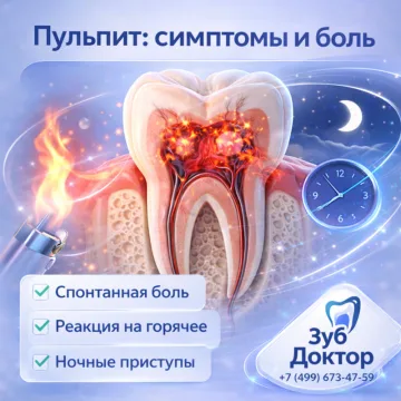 Пульпит зуба