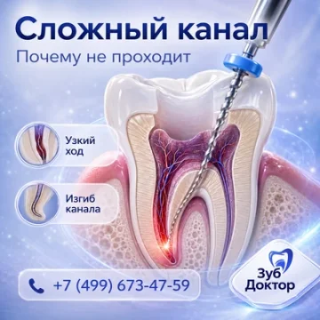 Канал зуба не проходит: почему лечение усложняется