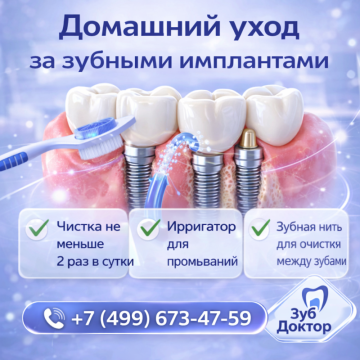 Как ухаживать за имплантами