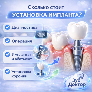 Стоимость Установки Имплантов