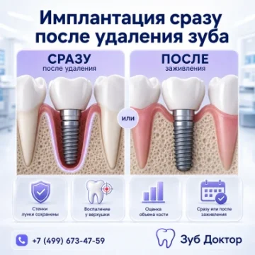 Удалять корень заранее или ставить имплант сразу