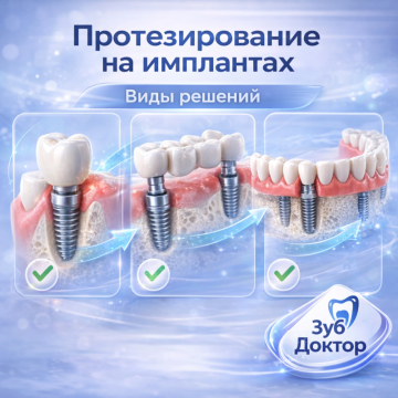 Протезирование на Имплантах
