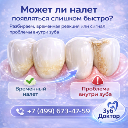 Налёт появляется быстро