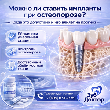 Импланты при остеопорозе