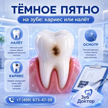Тёмное пятно на зубе: кариес или налёт