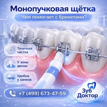 Монопучковая щётка и брекеты: чем помогает в уходе