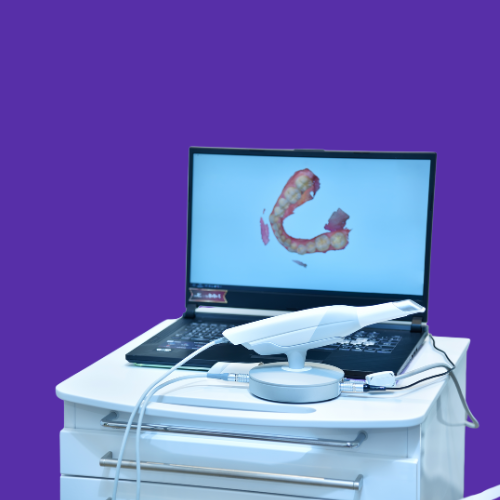 Кейс имплантации — до/после